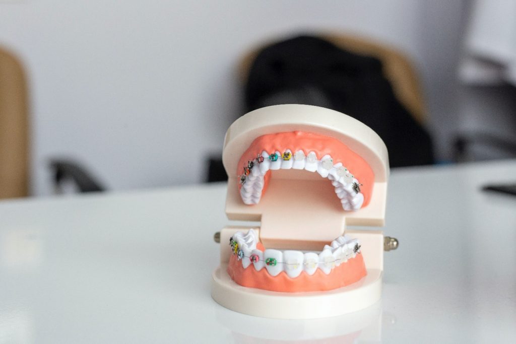 a dental model of the teeth